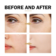 Firming Moisturizing Anti-wrinkle Whitening Skin